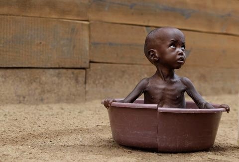 3. Cậu bé Aden Salaad (2 tuổi) gầy tong teo vì không có đủ thức ăn. Cậu bé chính là bức tranh khắc họa rõ rệt nhất nạn đói khủng khiếp đang hoành hành tại vùng Sừng châu Phi. (Ảnh: AP)
